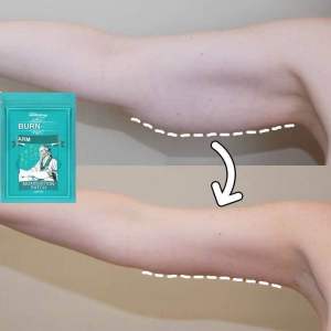 ARM SLIMMING PATCH kuruskan lengan gemuk kendur goyah mengelebar bentuk lengan cantik