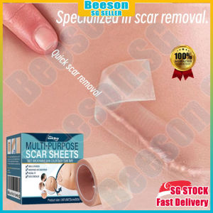 ⭐️SG stock⭐️ 5cm*5m Scar removal patch / Scar tape / Scar concealing tape / Tattoo cover sticker / Scar concealer patch 疤痕贴
