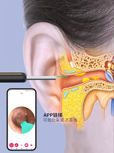 Visual Ear Pickup Ear With Camera Otoscope Ear Cleaning Tool Wireless Cleaning Endoscope High Definition Ear Picking Artifact可视挖耳勺