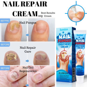 Sumifun Nail Repair Cream: Solusi Krim Perbaikan Kuku Jamur & Pembunuh Bakteri