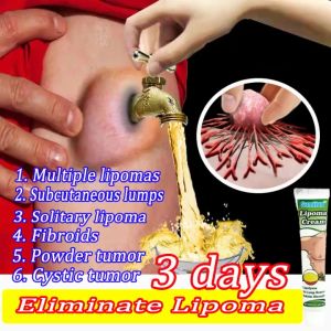 Multiple Single fat granule care lipoma removal cream lipolysis Removing skin care