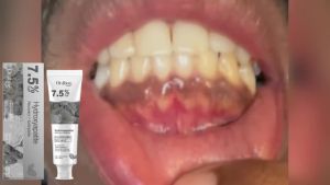 oralhoe | Hydroxyapatite Repair Toothpaste Cleaning Tartar Strengthen Tooth Enamel Breath Refreshing Oral Care Brightening Toothpaste 120g