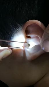 LED Flash Light Ear Cleaning Tools Ear-Pick Wax Remover Pick Earpick Clean Ears Cares For Kids Babys 1 Pcs Baby Ear Spoon With LED Flash Light Ear Cleaning Tools (No Batteries And Magnifying Glass)