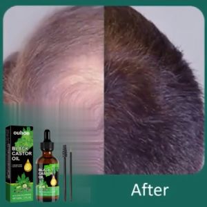 OUHOE Castor Oil Growth Solution Natural Hair Growth Liquid Equipped With Eyeliner Brush And Eyelash Brush Eyelashes Eyebrow Growth Liquid Hair Fast Growth Liquid Castor Oil Essential Oil For Hair Eyelashes Eyebrows Growth 60ml