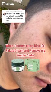 Blem Dr The Ultimate Pekas Cream & Toner Whitening Rejuvenating Exfoliating Moisturizer Face Cream Beauty Skin Care Niacinamide Aloe Vera Calamansi Dark Spot Melasma Freckles Pore Pimple Acne Blackheads Oil Control Anti Aging Glass Skin For Men & Women