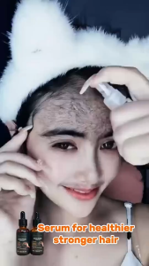 Dr. Lan Black Sesame Hair Growth Serum Reduce Hair Loss Strengthen Roots Support Hair Growth Ginseng Extract Nourish Scalp Prevent Hair Loss 30ml