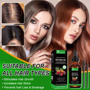 Batana Essential Oil For Hair Growth Deep Cleaning Follicles Prevent Baldness Alopecia Nourishing Thicken Anti Hairs Loss Hair Care