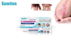 High Quality [ Spot inventory ] sumifun Cream Calamine Skin Acne Relieving Itching Soothing Cream Stubborn Dermatitis Loose Skin Ringworm White Cream  K10180