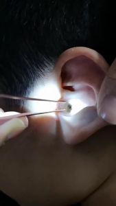 Lighted Ear Spoon for Kids Soft Tip Illuminated Ear Pick Baby Ear Cleaning Tool Visible Ear Tweezers Clip Kit Safe Luminous C620