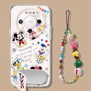 NAZHIMING | Ốp Lưng Điện Thoại Có Kính Trong Suốt Cho Huawei Mate 80 Pro Max Mickey Minnie