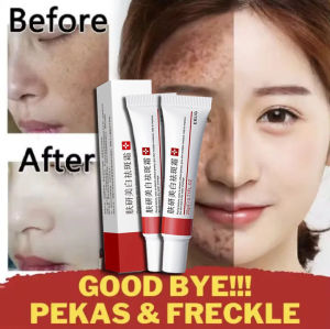 Effective and Original Whitening Freckle Cream 100% Remover Melasma Acne Melanin Pigmentation Moisturizing Skin Care 20g