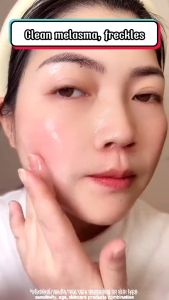 100% Effective Melasma Cream Whitening Cream with Collagen Original for face remove Pekas & Freckles