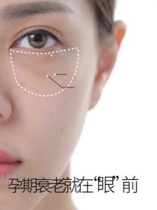 【4315次回购】植物主义眼膜贴准孕妇可用缓解眼疲劳保湿补水去眼袋学生可用