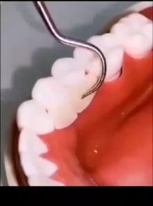 Tusuk Gigi Stainless 7 in 1/ Alat Pembersih Gigi Anti Karat Anti Patah