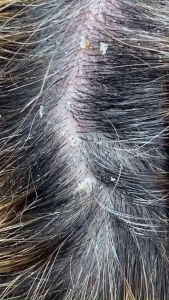 Tẩy tế bào da đầu peeling capilo eva professional không chứa silicone paraben sunfate nhập khẩu tây ban nha