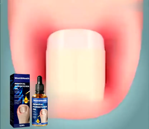Tinh chất phục hồi móng Phục hồi móng Móng kháng khuẩn chân loại nấm móng gãy 10ml