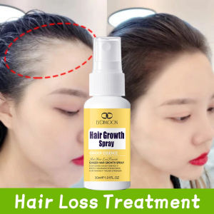 Hair Growth Spray Hair Tonic For Growth 30ml Hair Growth Serum Anti Hair Loss Herbs Hair Care For Men And Women Prevents Balding ginger essence