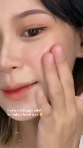 [OFFICIAL] KOJIC PLANKTON WHITE GLOW ESSENCE SERUM 20 ML