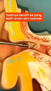 Set Pembersih Telinga Korek Kuping Ear Spoon Tool 6PCS 6 in 1 / Pembersih telinga 1 set full Pembersih telinga led kamera Pembersih telinga kamera