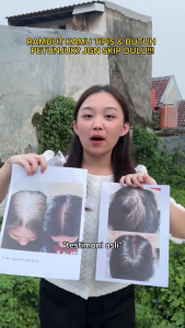 SHRD | Red Ginseng | Hair Fall Shampoo | Shampo Rambut Rontok | Tipis | Bantu Kuatkan Akar Rambut | Hair Loss