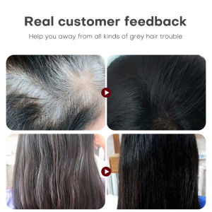 Black Hair Shampoo 300ml Anti hair loss，Moisturizing Shampoo Promotes Hair Growth Thicker Relieve itchy scalp Man & Woman Bald Regrowth Hair Dense Fast Permanent Black Hair Dye 3 in 1 Nourishing Protecting Nature Dyeing Black Colour Hair Treatment