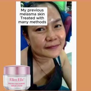 Ellen Ella Radiant Niacinamide Rose Serum Cream 30ml Whitening Anti-aging Moisturizing