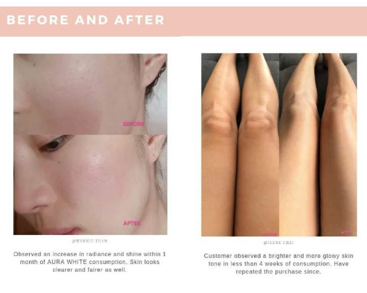 Dr.%20Ora%20AURA%20WHITE%20ULTRA%20Skin%20Whitening%20Supplement%20/%20Anti-aging%20/%20Brightens%20skin%20/Lightens%20Dark%20Spots%20/%20Whitening%20UV%20Protection%20Beauty%20Supplement%205g%20x%2030s%20%5BMulti%20Award%20Winning%5D%20-%20Image%207