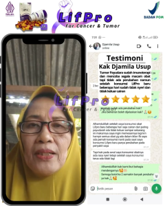 LifPro Obat Kelenjar Getah Bening Benjolan Pada Tubuh Izin Resmi BPOM