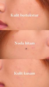PERFECT WHITE AHA Whitening Serum for Face | 10X AHA 5X Ceramide | Serum Wajah | Mencerahkan Wajah