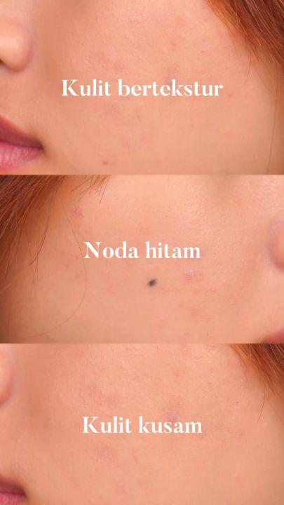 PERFECT WHITE AHA Whitening Serum for Face | 10X AHA 5X Ceramide | Whitening, Moisturizing Gentle Exfoliate | AHA Serum Wajah