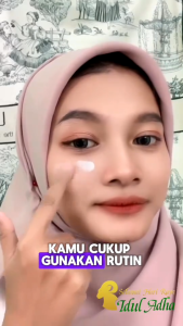 CHALONESE Niacinamide Brightening Cream 20g - Penghilang Flek Hitam & Mencerahkan Kulit