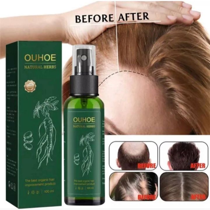 Ginseng Ginger Fast Hair Growth Serum Spray 100ml Anti Hair Loss Liquid Natural Ectract Hair 3169