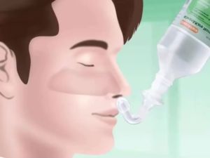 Klean and Kare Nasal Connect คลีนแอนด์แคร์ นาซาลคอนเนค จุกล้างจมูก เหมาะสำหรับน้ำเกลือขวดปลายแหลม ใช้งานง่าย แค่ต่อกับปลายขวด