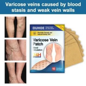 15pcs Varicose Veins Herbal Heling Patch Koyo Varises Herbal