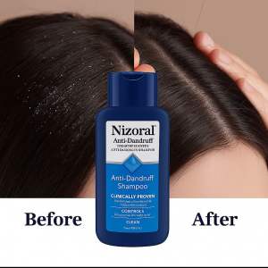 แชมพูขจัดรังแค 200ml แชมพูลดอาการคันนหนังศีรษะกลิ่นหอมติดทนนานให้ความชุ่มชื้นสดชื่นอ่อนโยนทําความสะอาดหนังศีรษะ