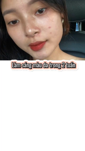 kem dưỡng trắng da mặt MSH Chống oxy hóa làm trắng da giảm melanin Niacinamide SKINTIFIC 30g