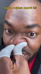 GMEELAN Orange Exfoliating Gel Face Blackhead Cleaner Hydrating Gel 50g 2PCS