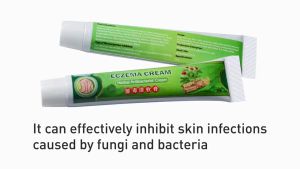 Eczema Cream Krim Psoriasis Cream Gatal Ketuat Krim Eczema Treatment Antifungal Cream Itchy krim ekzema