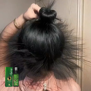 【Buy 1 Take 1】Jaysuing Giải pháp chăm sóc tóc Massage nhẹ nhàng nuôi dưỡng da đầu dưỡng ẩm tóc mềm mại xịt chăm sóc tóc Serum mọc tóc Tinh chất dưỡng tóc Tinh Chất Chống Rụng Tóc kích thích mọc tóc nhanh làm dày giúp giảm rụng tóc giải 30ml/120ml