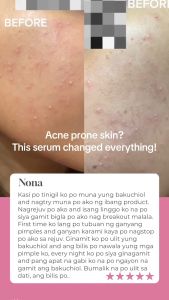 [BUY 1 GET 1 - with FDA Notification] Bakuchiol Serum for Acne Prone Sensitive Dry Skin by RGSKIN – Gentle Anti-Aging & Brightening with Niaciamide Vitamin C Peptides Anti Aging Whitening Renewing Skin Reduce Melasma Hyperpigmentatation | FDA Licensed