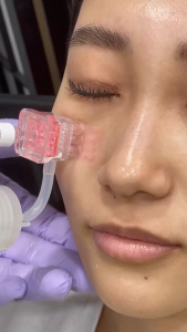 New Injection Meso Gun for Beauty Skin Rejuvenation Facial Lifting Wrinkle Removal Mesotherapy Gun Skin Tightening