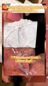 LANBENA Blackhead Removal Mask Nose Plants Pore Strips Original Blackhead Whiteheads Remover Facial Peeling Mask Acne