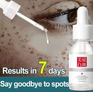 Freckle Serum Original - Dark Spots/Melasma Remover Cream from Japan Retinol Anti Pekas & Whitening Facial Care Serum (Retinol)