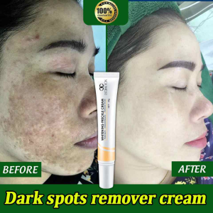Whitening Cream Niacinamide Face Cream Brightening Skin Tone Remove Dark Spots 20g Collagen Day Night Cream Moisturizer Anti-Aging Whitening Cream For Dark Spots & Wrinkle