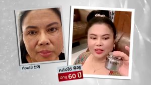 ครีมโบท็อกซ์ 6 กระปุก BARCONY ครีมโบท็อกซ์  เกาหลี ยกกระชับ หน้าตึง แบบกระปุก 40 กรัม Korea so โคเรีย โซ