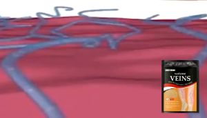 South Moon Varicose Veins Relief Cold Compress Vein Patch for Varicose Veins on Legs 12pcs