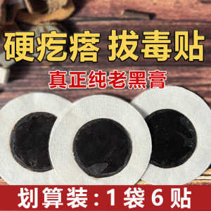 Kem Giảm Sưng Khối Cứng Điểm Đỏ Hút Dịch Đầu Thuốc Diệt Côn Trùng Dùng Tại Nhà Bảo Vệ Đầu Gối Eo Vai Vai Gáy