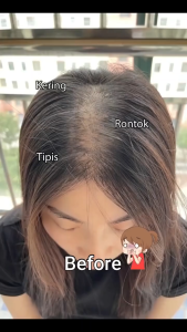 Remimpi Shampoo anti Hair fall Treatment Oil Control Anti Dandruff Shampo Penumbuh Rambut Rontok Original