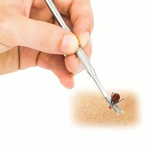 Kẹp nhíp bắt ve rận cho chó mèo bằng thép không gỉ - Love Pets Shop