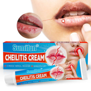 Sudety Cheilitis Cream Bibir Moisturizing Pelembab Bibir Peradangan Kulit Pada Area Bibir Herpes Di Bibir Kering Dan Bibir Pecah Pecah COD